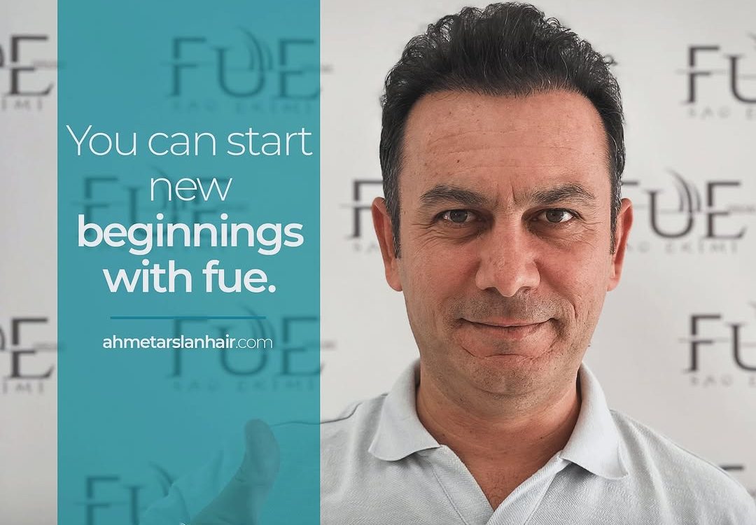 ankara-fue-sac-ekimi