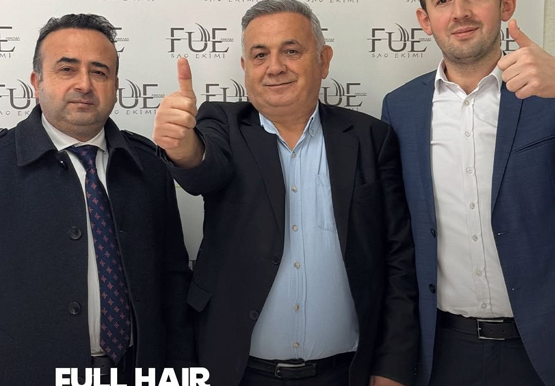 sac-ekimi-fiyatlari-2025